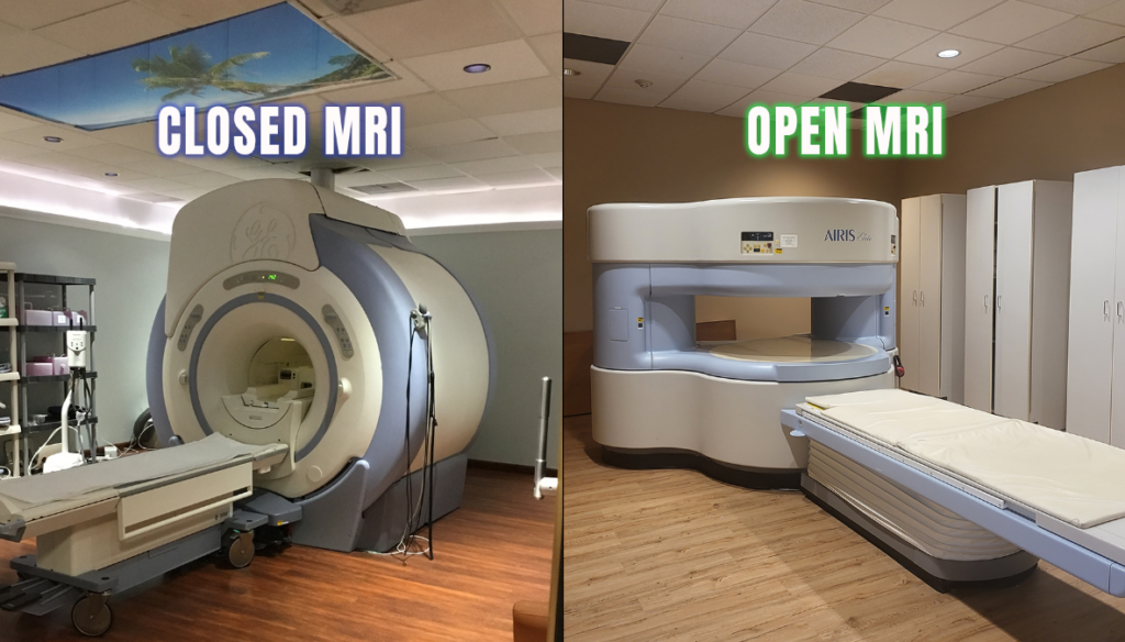 open mri