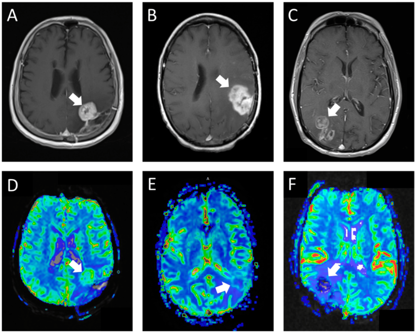 brain MRI Lucknow