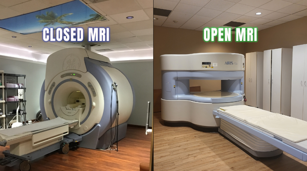 closed mri vs open mri