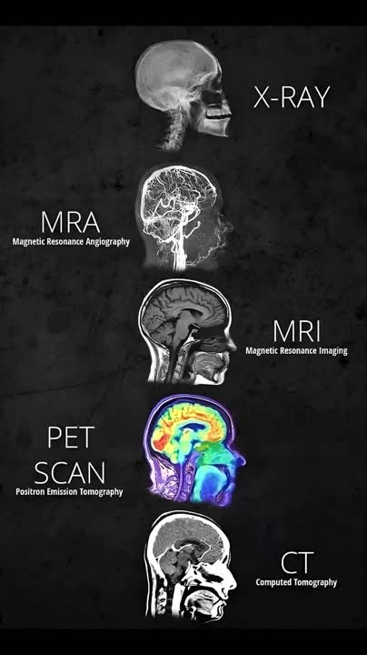 mra ct scan